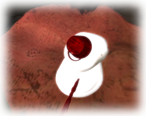 SL photo